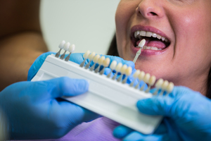 Dentist examining female patient with teeth shades at dental clinic Beratung zu implantatgetragenem Zahnersatz beim Zahnarzt in Lörrach